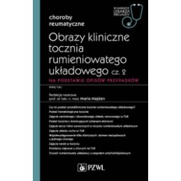 Obrazy kliniczne tocznia...