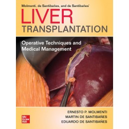 Liver Transplantation:...