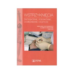 Wstrzyknięcia śródskórne,...