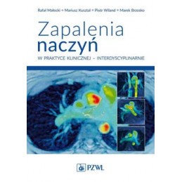 Zapalenia naczyń w praktyce klinicznej - interdyscyplinarnie