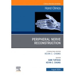 Peripheral Nerve Reconstruction, An Issue of Hand Clinics