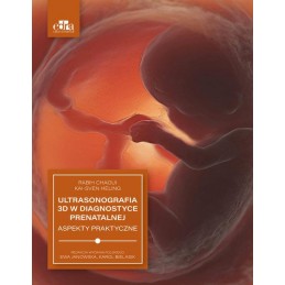 Ultrasonografia 3D w diagnostyce prenatalnej