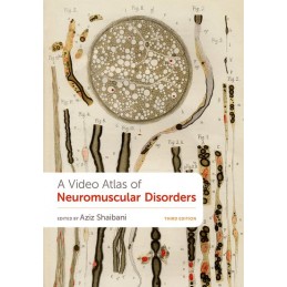 A Video Atlas of Neuromuscular Disorders