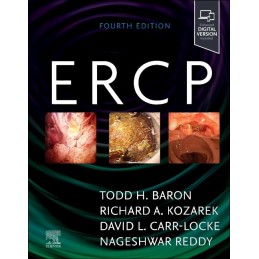 ERCP