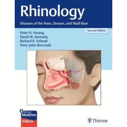 Rhinology: Diseases of the Nose, Sinuses, and Skull Base