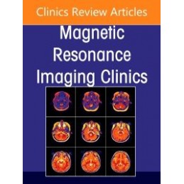 Spine Imaging, An Issue of...