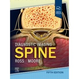 Diagnostic Imaging: Spine