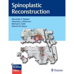 Spinoplastic Reconstruction