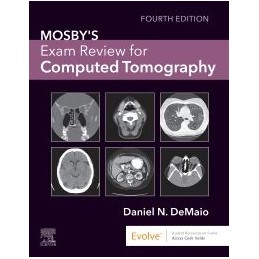 Mosby's Exam Review for Computed Tomography