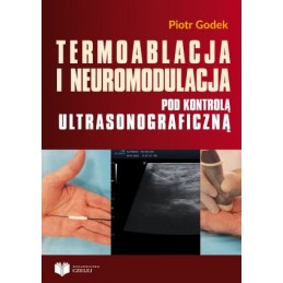 Termoablacja i neuromodulacja pod kontrolą ultrasonograficzną