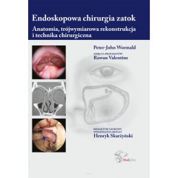 Endoskopowa chirurgia zatok