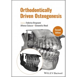 Orthodontically Driven Osteogenesis