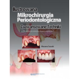 Ilustrowana mikrochirurgia periodontologiczna. Zaawansowane techniki.