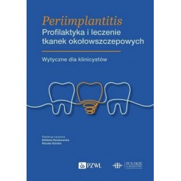 Periimplantitis Profilaktyka i leczenie tkanek okołowszczepowych.