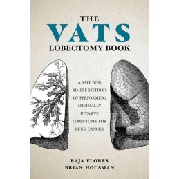 The VATS Lobectomy Book