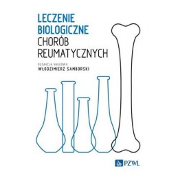 Leczenie biologiczne chorób reumatycznych