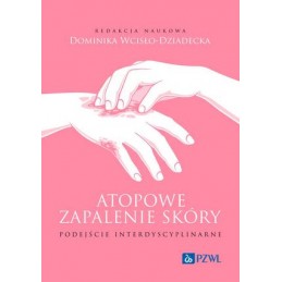 Atopowe zapalenie skóry. Podejście interdyscyplinarne.