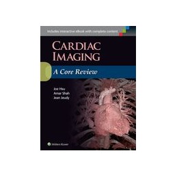Cardiac Imaging: A Core Review