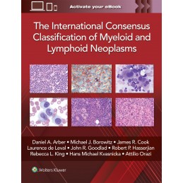 The International Consensus Classification of Myeloid and Lymphoid Neoplasms The International Consensus Classification of Myeloid and Lymphoid Neoplasms