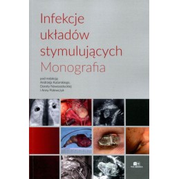 Infekcje układów stymulujących