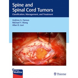 Spine and Spinal Cord...