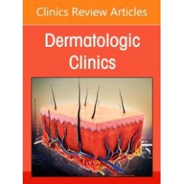 Hidradenitis Suppurativa,...