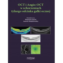 OCT i Angio-OCT w...