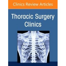 Pulmonary Metastasectomy, An Issue of Thoracic Surgery Clinics Pulmonary Metastasectomy, An Issue of Thoracic Surgery Clinics