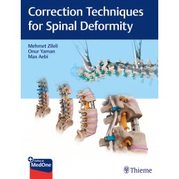 Correction Techniques for Spinal Deformity Correction Techniques for Spinal Deformity