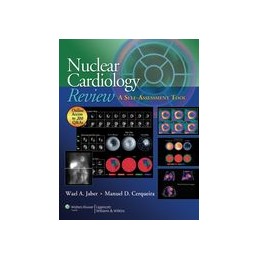 Nuclear Cardiology Review