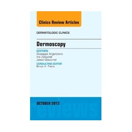 Dermoscopy, an Issue of Dermatologic Clinics Dermoscopy, an Issue of Dermatologic Clinics
