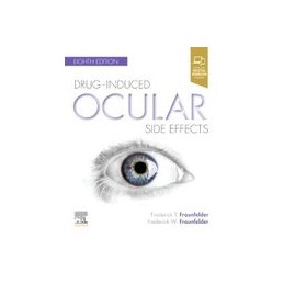 Drug-Induced Ocular Side Effects Drug-Induced Ocular Side Effects