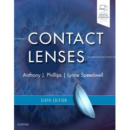 Contact Lenses Contact Lenses