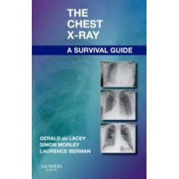 The Chest X-Ray: A Survival Guide The Chest X-Ray: A Survival Guide