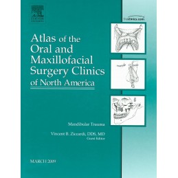 Mandibular Trauma, An Issue...