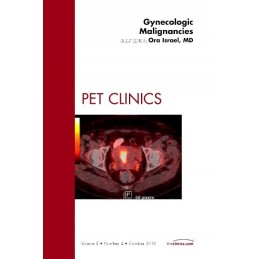 Gynecologic Malignancies, An Issue of PET Clinics Gynecologic Malignancies, An Issue of PET Clinics