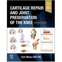 Cartilage Repair and Joint Preservation of the Knee
