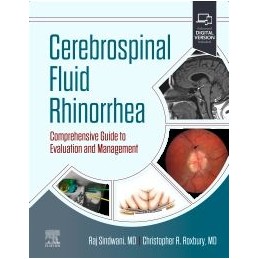 Cerebrospinal Fluid Rhinorrhea Cerebrospinal Fluid Rhinorrhea