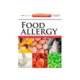 Food Allergy Food Allergy