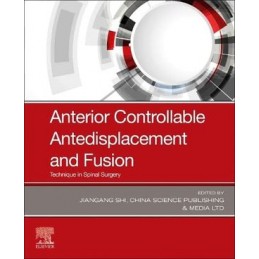 Anterior Controllable Antedisplacement and Fusion