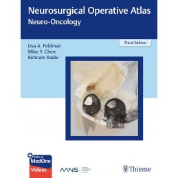 Neurosurgical Operative Atlas: Neuro-Oncology