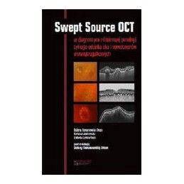 Swept Source OCT w diagnostyce patologii tylnego bieguna oka i nowotworów wewnątrzgałkowych Swept Source OCT w diagnostyce patologii tylnego bieguna oka i nowotworów wewnątrzgałkowych