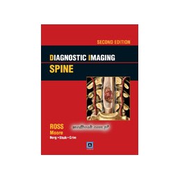 Diagnostic Imaging: Spine