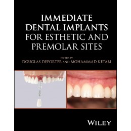 Immediate Dental Implants for Esthetic and Premolar Sites Immediate Dental Implants for Esthetic and Premolar Sites