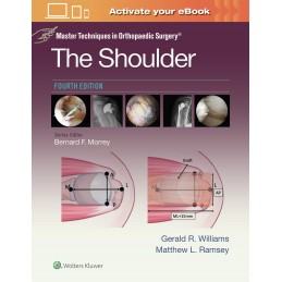 Master Techniques in Orthopaedic Surgery: The Shoulder: Print + digital version with Multimedia