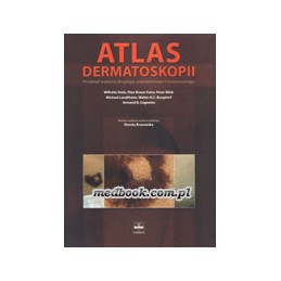 Atlas dermatoskopii