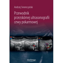 Przewodnik przezskórnej...