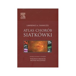 Atlas chorób siatkówki