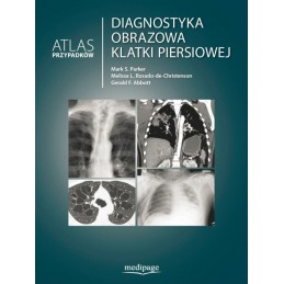 Diagnostyka obrazowa klatki...