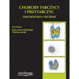 Choroby tarczycy i...